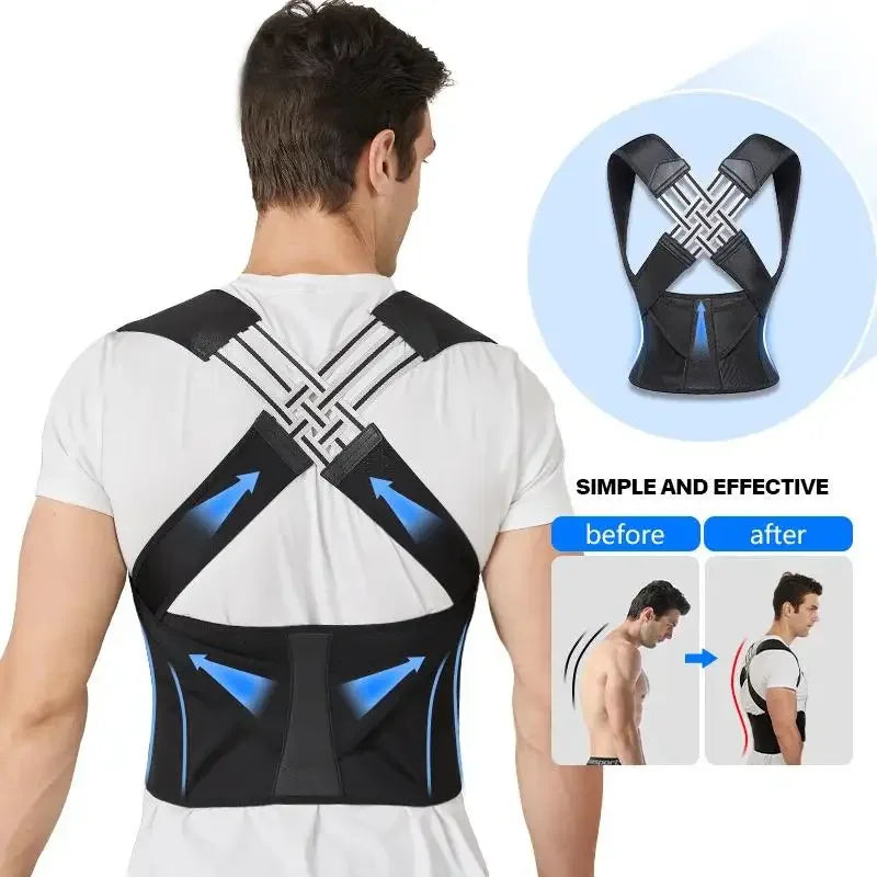 Advanced Posture Correction Vest – Adjustable Back Support & Breathable Waist Trainer for Spine Alignment